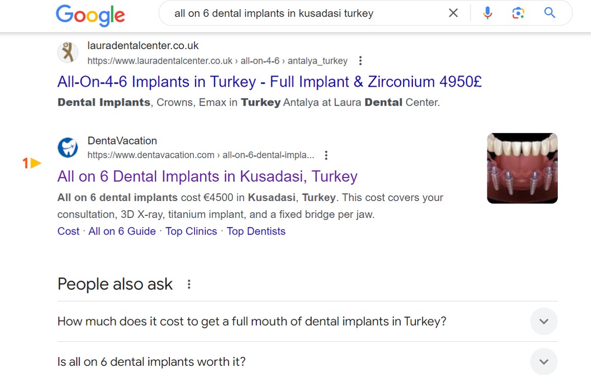 All on 6 Dental Implants in Kusadasi Turkey - UK#1