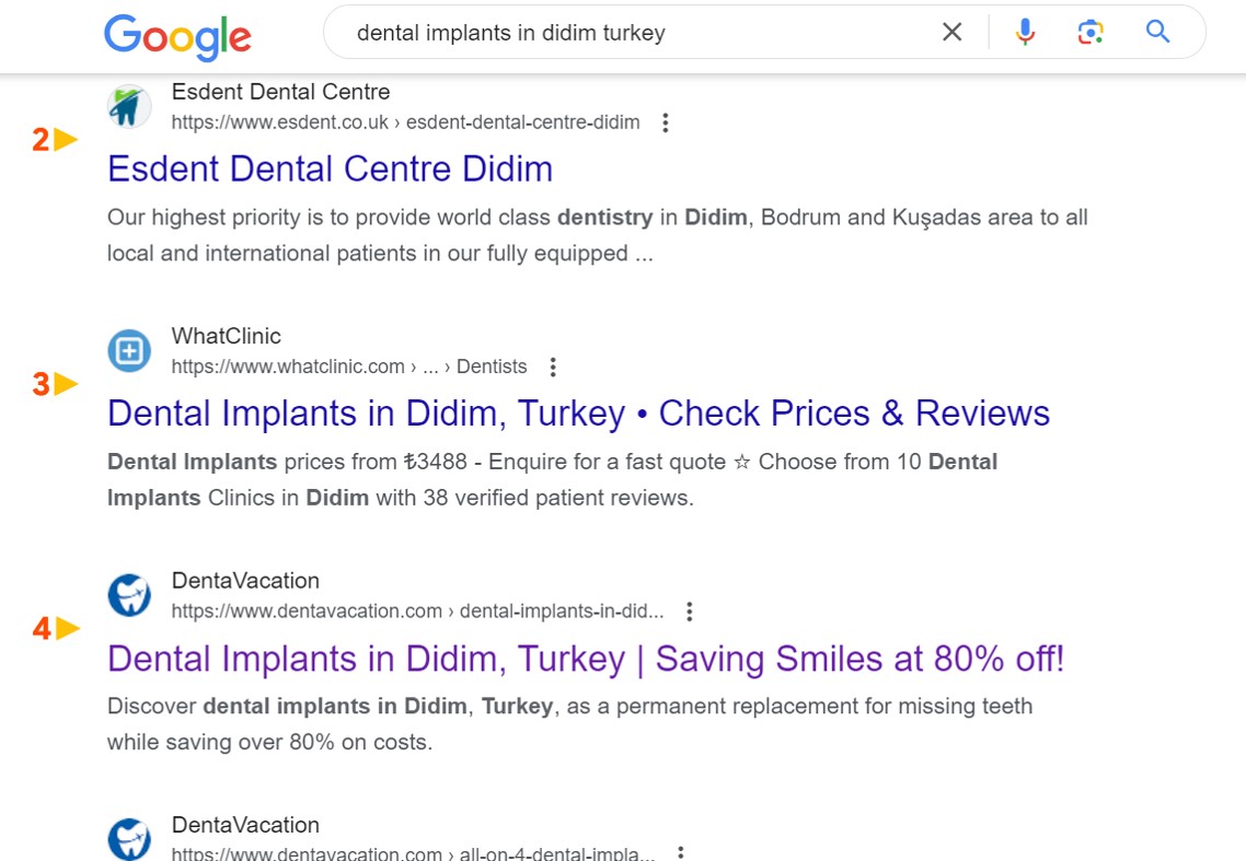 Dental Implants in Didim Turkey - UK#4