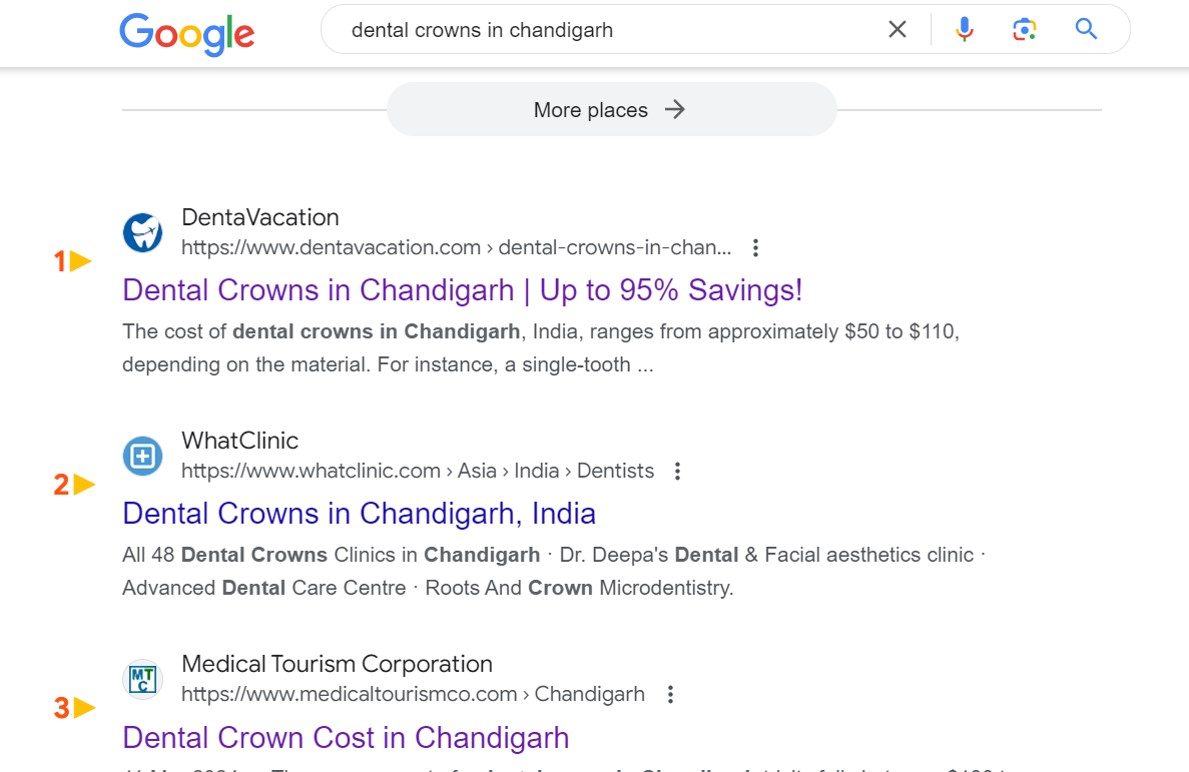 Dental crowns in Chandigarh - UK#1