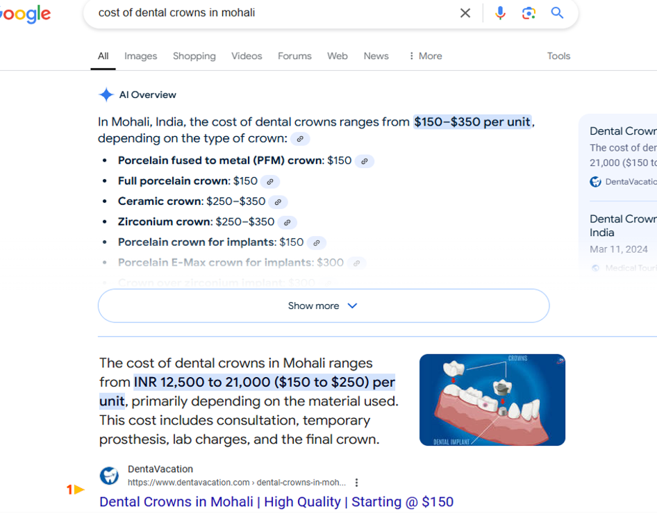 FS Cost of dental crowns - 946_746