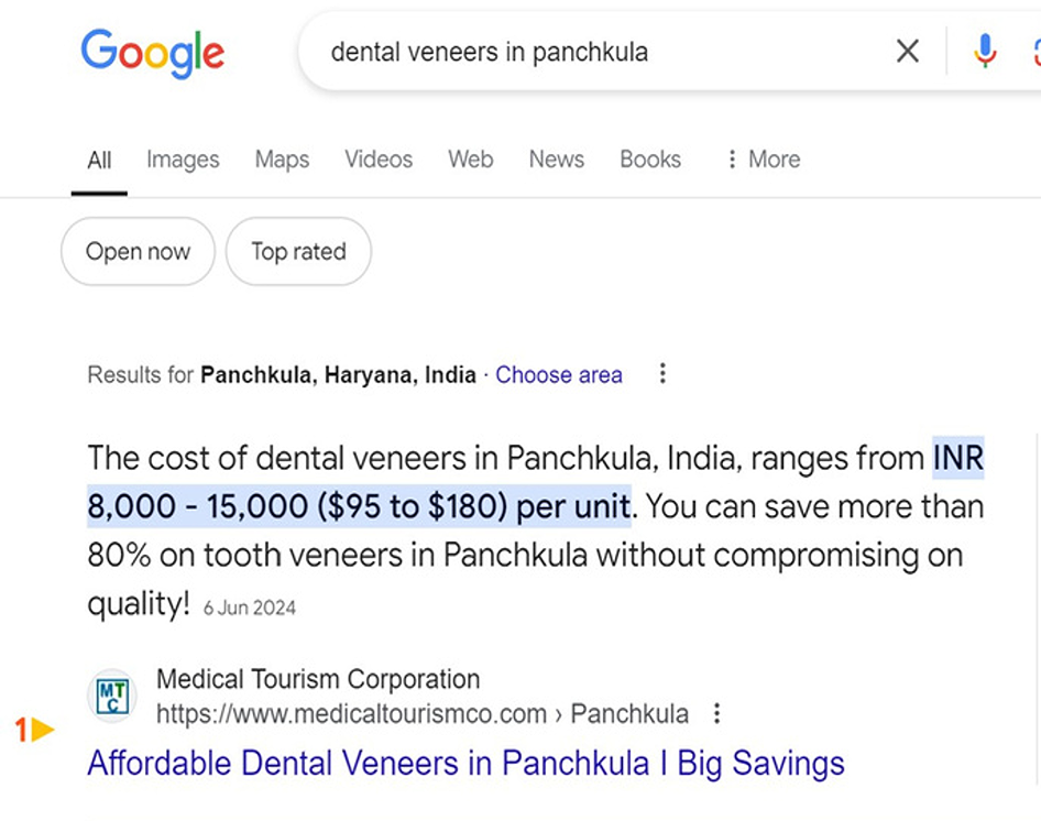 FS Dental veneers in 946_746