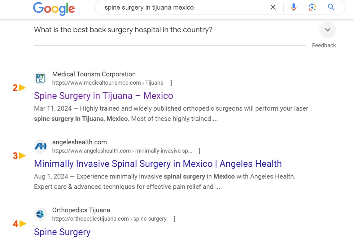 Spine Surgery in Tijuana Mexico - US#2